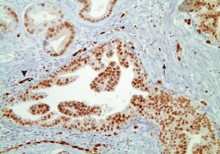 kjpathol-47-307-g005.jpg