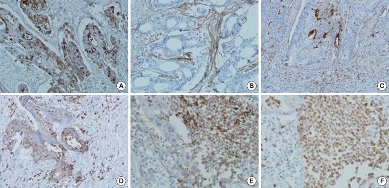 kjpathol-47-340-g001.jpg