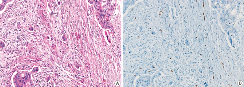 kjpathol-47-355-g002.jpg