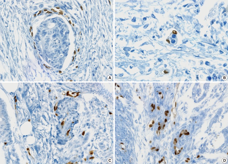 kjpathol-47-355-g005.jpg