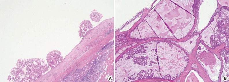 kjpathol-47-36-g003.jpg