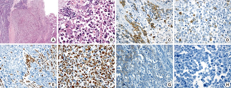 kjpathol-47-372-g002.jpg