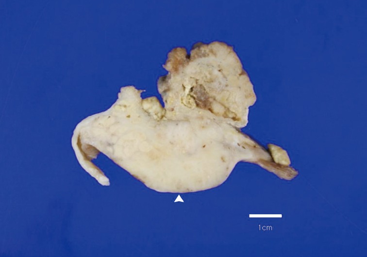 kjpathol-47-383-g001.jpg