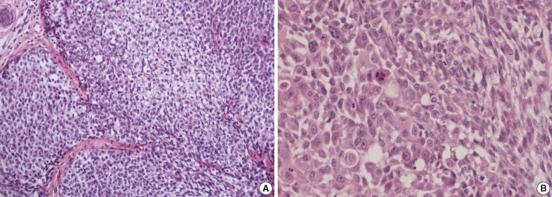 kjpathol-47-383-g003.jpg