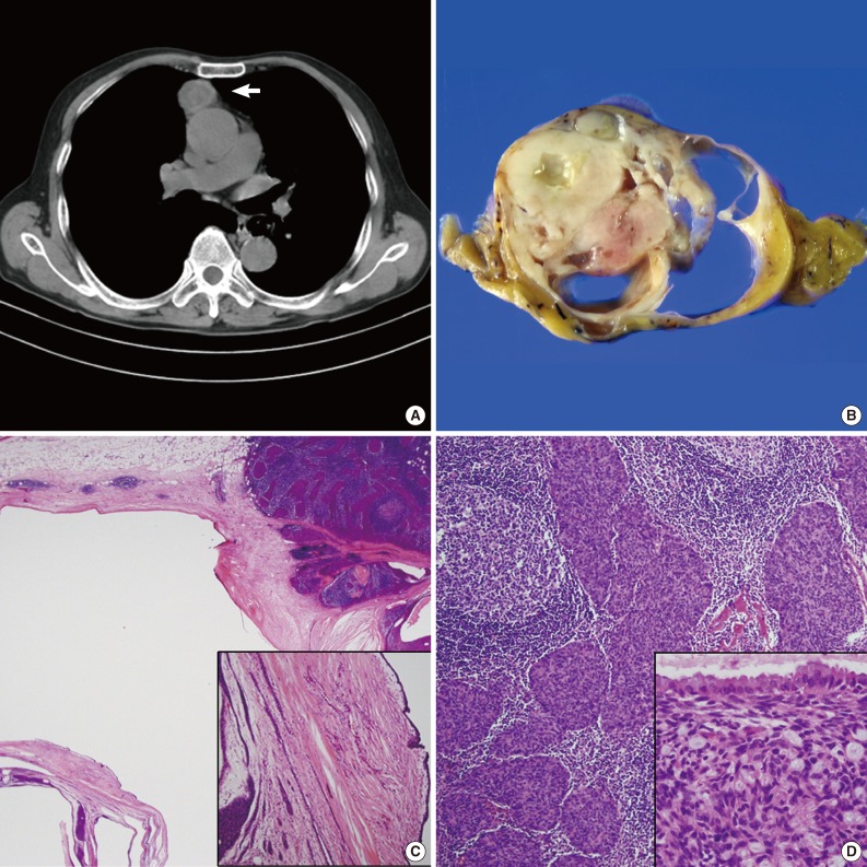 kjpathol-47-392-g001.jpg