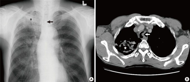 kjpathol-47-399-g001.jpg