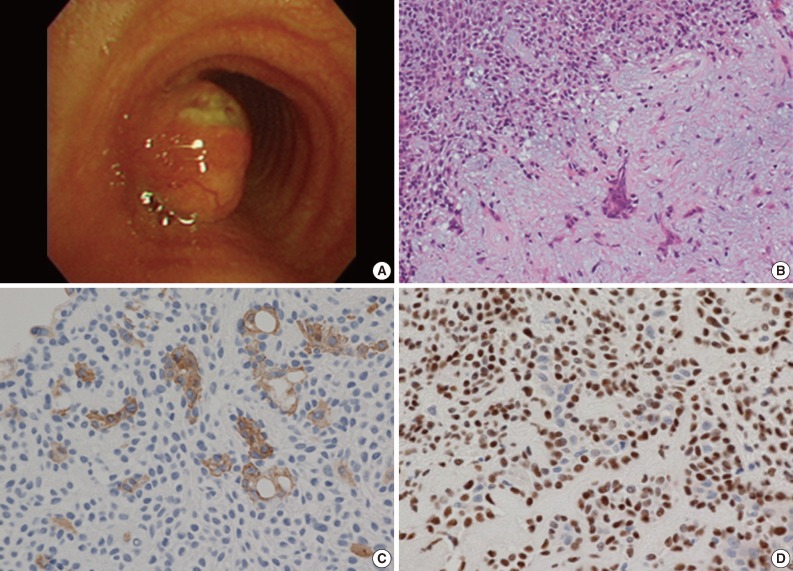 kjpathol-47-399-g002.jpg