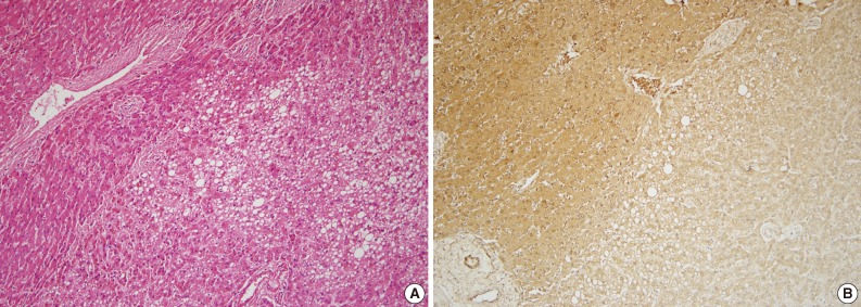 kjpathol-47-411-g001.jpg