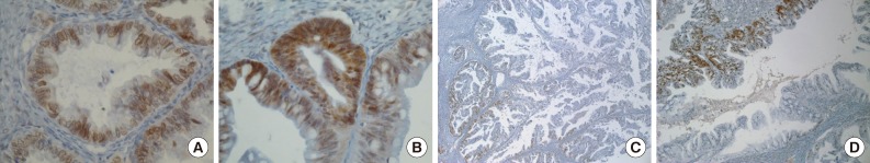kjpathol-47-418-g002.jpg