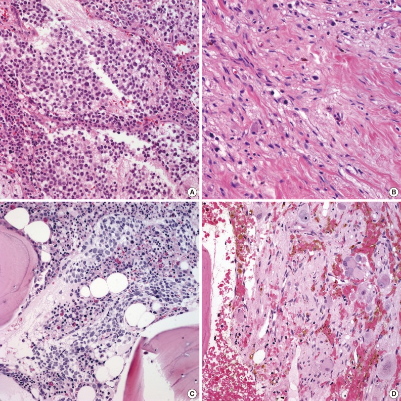 kjpathol-47-433-g002.jpg