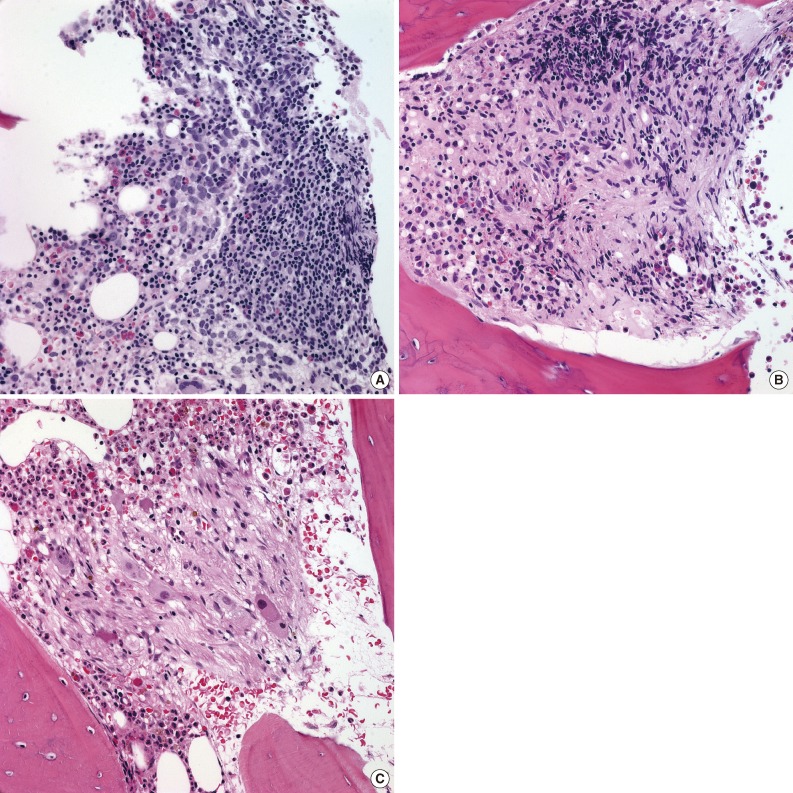 kjpathol-47-433-g003.jpg