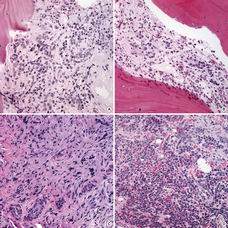 kjpathol-47-433-g004.jpg