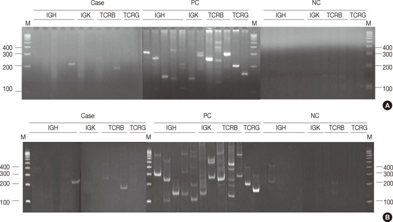 kjpathol-47-458-g001.jpg