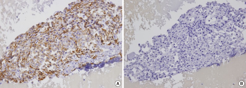 kjpathol-47-466-g001.jpg