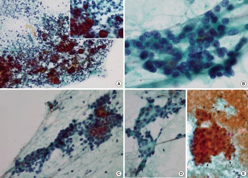 kjpathol-47-481-g001.jpg