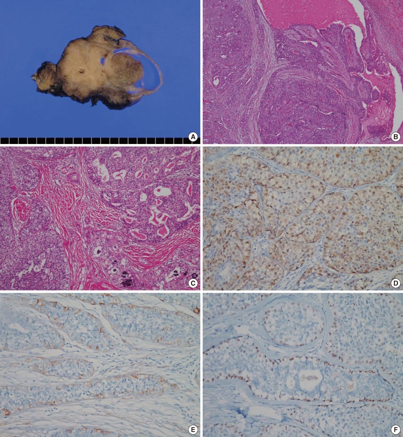 kjpathol-47-481-g002.jpg