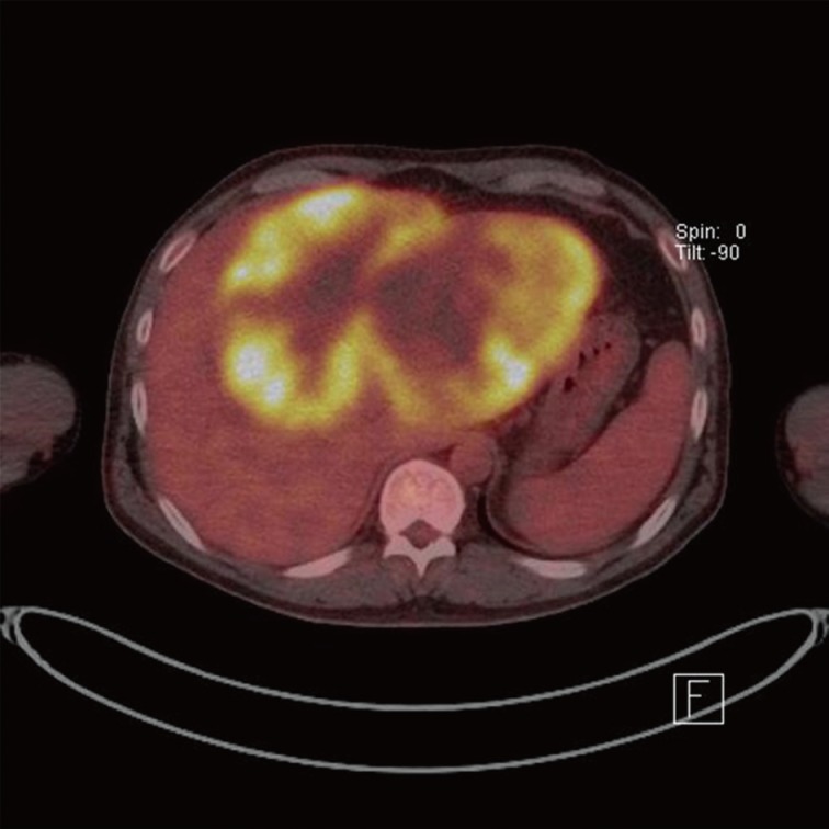 kjpathol-47-486-g002.jpg