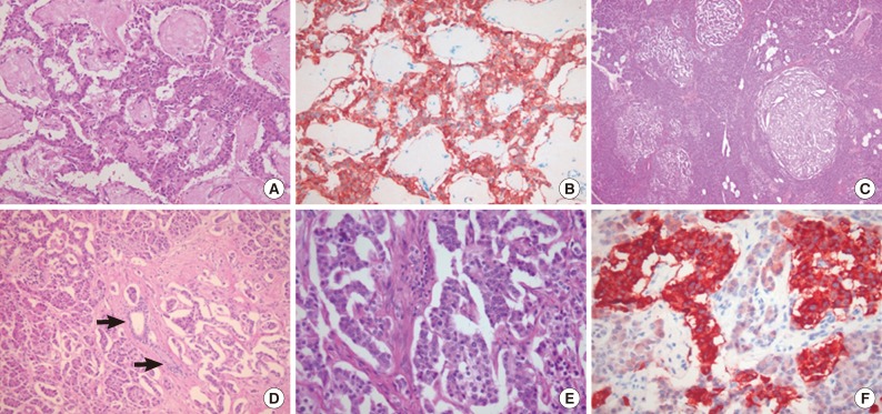 kjpathol-47-489-g002.jpg