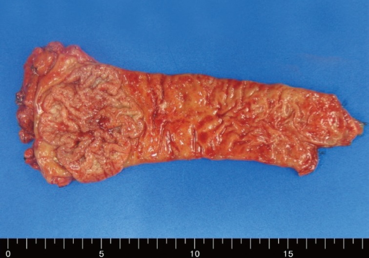 kjpathol-47-495-g001.jpg