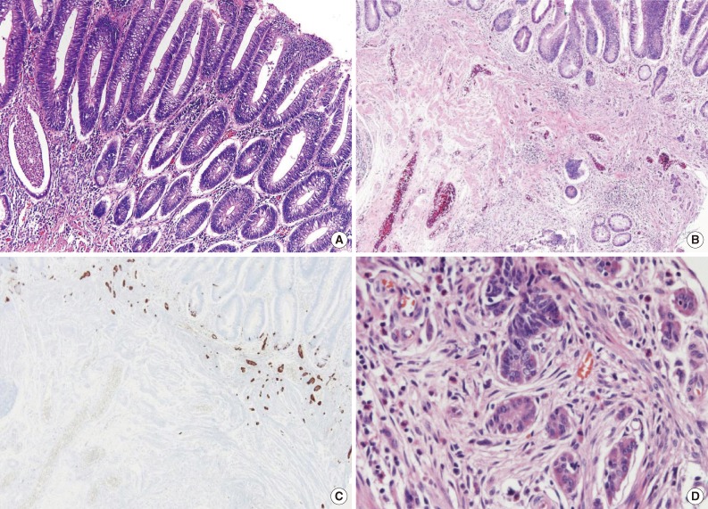 kjpathol-47-495-g002.jpg