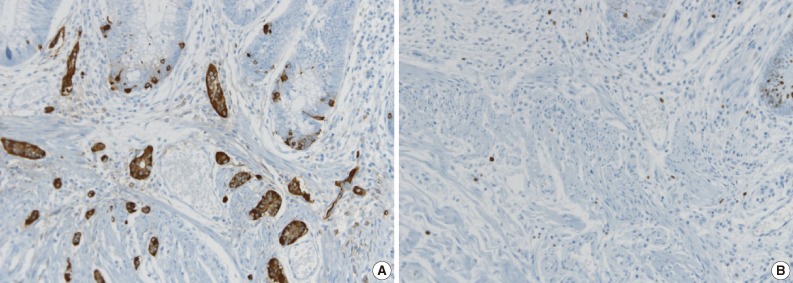 kjpathol-47-495-g003.jpg