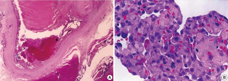 kjpathol-47-499-g002.jpg