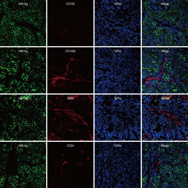 kjpathol-47-507-g006.jpg