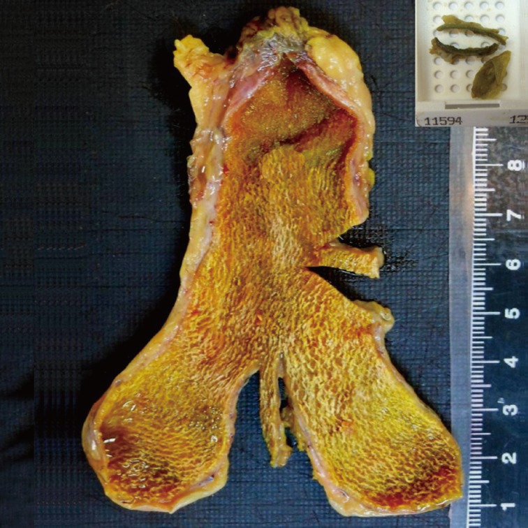 kjpathol-47-519-g001.jpg