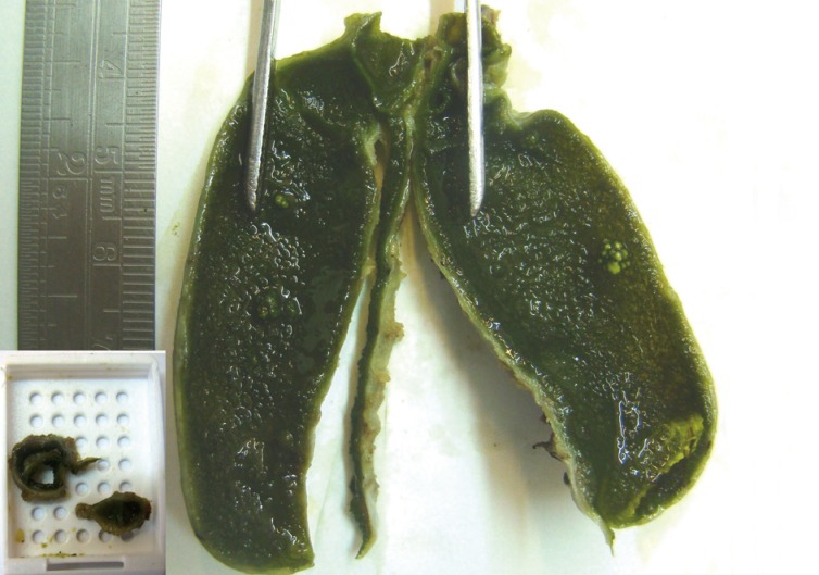 kjpathol-47-519-g002.jpg