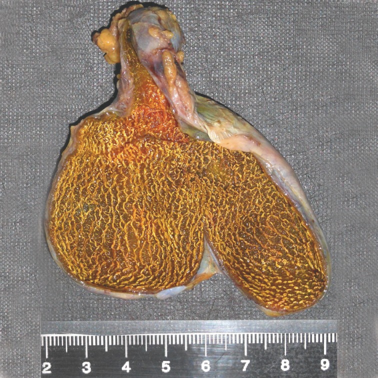 kjpathol-47-519-g003.jpg