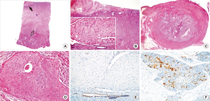 kjpathol-47-549-g001.jpg