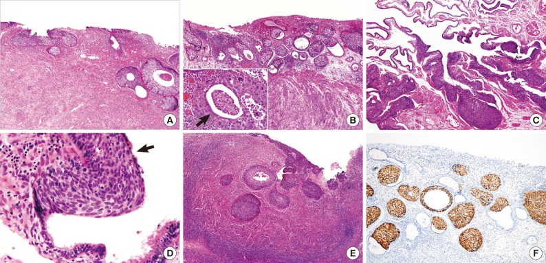 kjpathol-47-549-g002.jpg