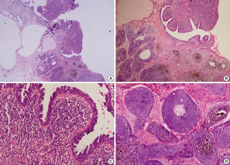 kjpathol-47-569-g002.jpg