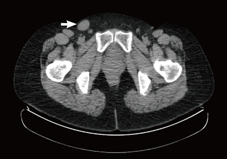 kjpathol-47-583-g001.jpg