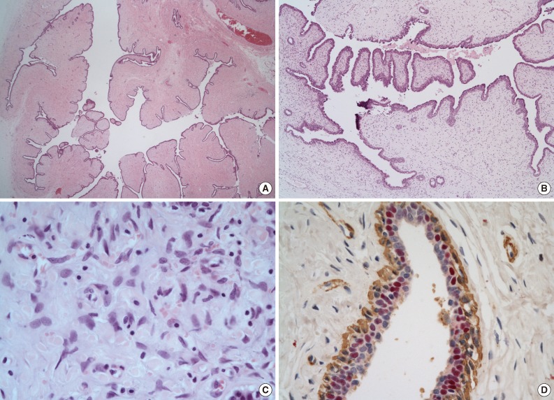 kjpathol-47-583-g003.jpg