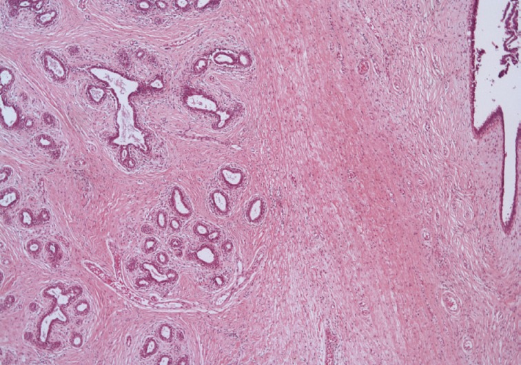 kjpathol-47-583-g004.jpg