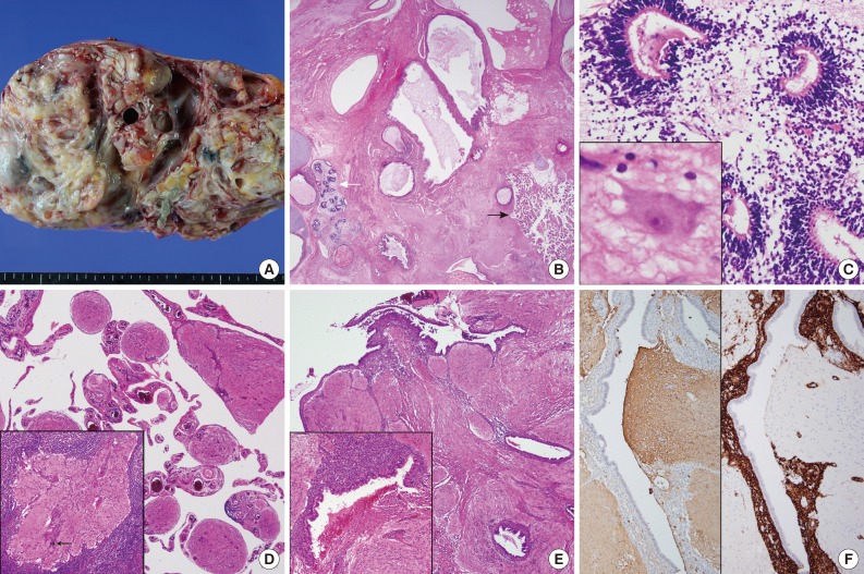 kjpathol-47-587-g001.jpg