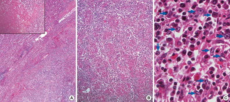 kjpathol-47-599-g002.jpg