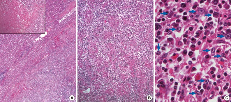 kjpathol-47-599-g002.jpg