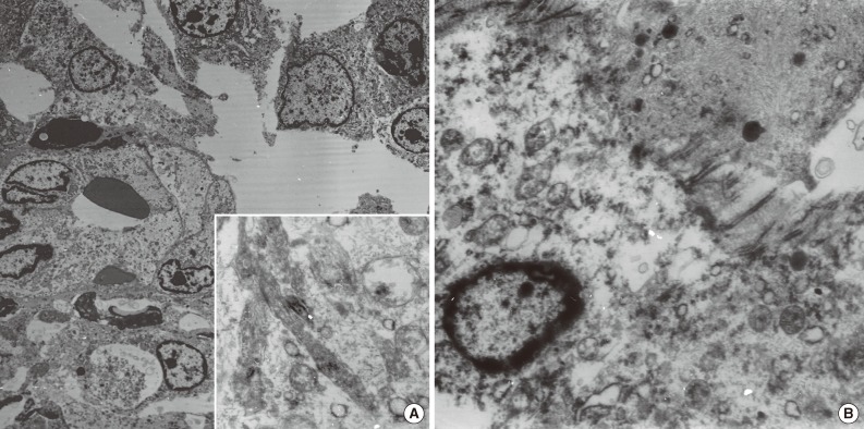 kjpathol-47-606-g003.jpg