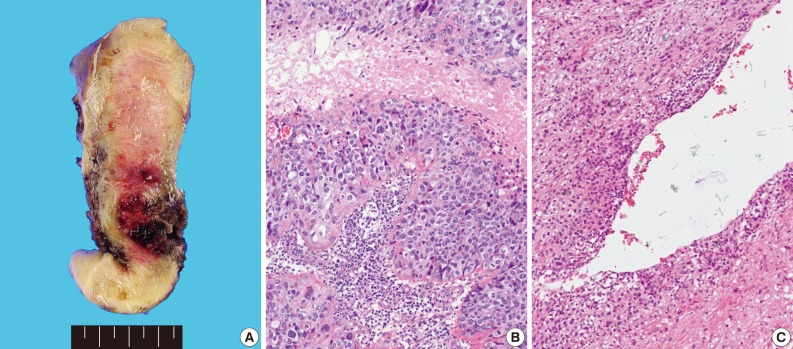 kjpathol-47-67-g001.jpg