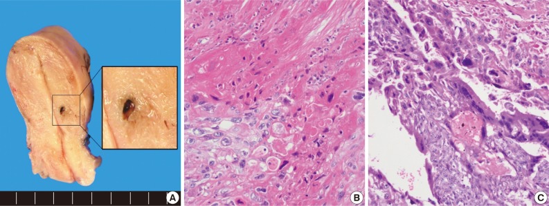 kjpathol-47-67-g002.jpg