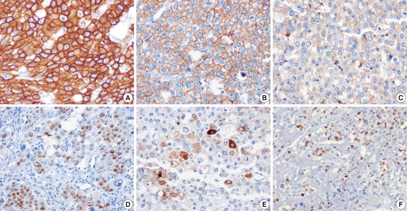 kjpathol-47-67-g004.jpg