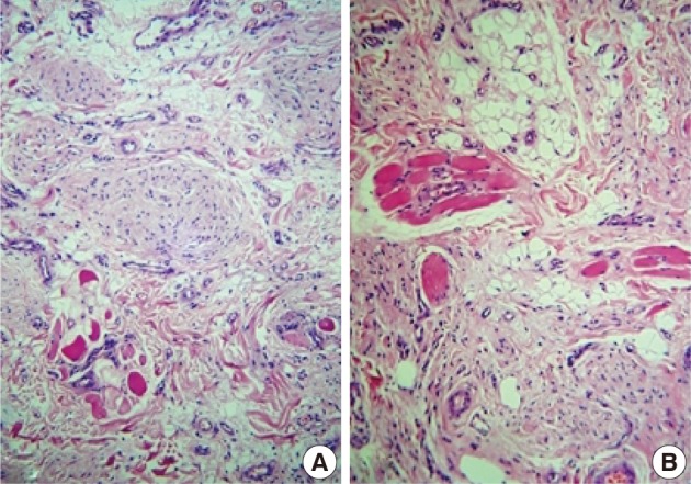 kjpathol-47-74-g002.jpg