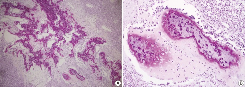 kjpathol-47-77-g003.jpg