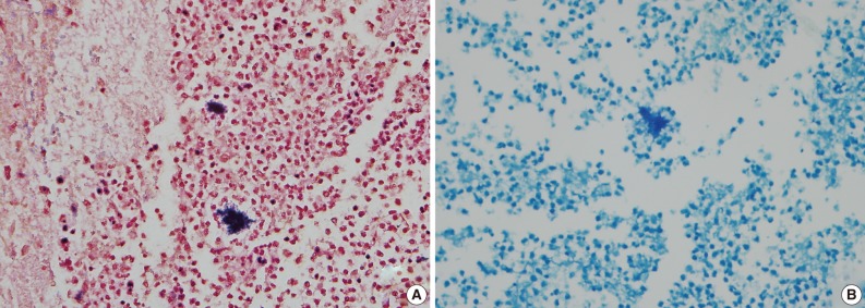 kjpathol-47-82-g003.jpg