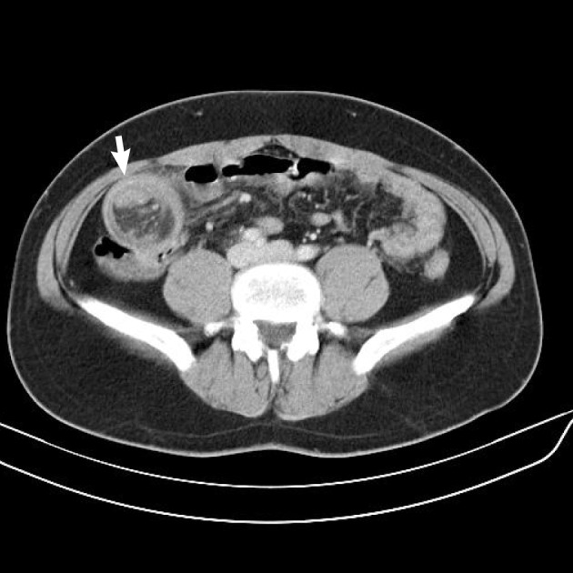 kjpathol-47-86-g001.jpg