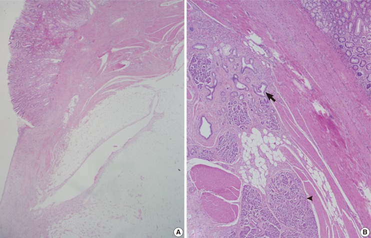 kjpathol-47-86-g003.jpg