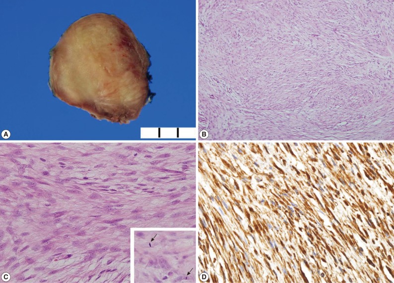 kjpathol-47-89-g002.jpg