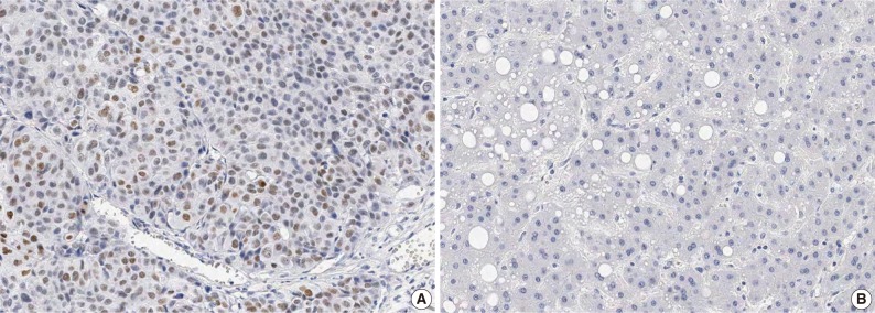 kjpathol-47-9-g001.jpg